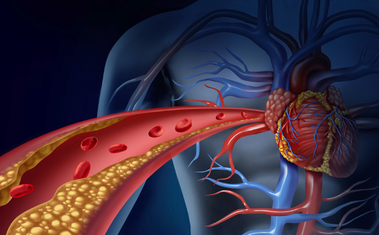 what-is-cholesterol-what-causes-high-cholesterol-crossroads-family-care